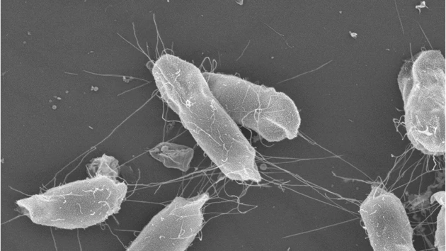 Bacteria under the microscope